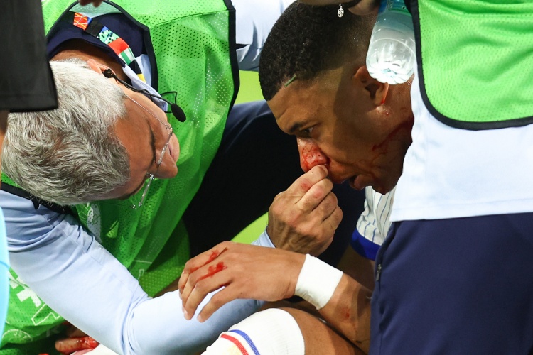  橄榄球运动员为姆巴佩提供面具建议，他曾受类似伤并休息了23天